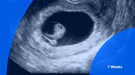 7 Weeks Old Newborn
