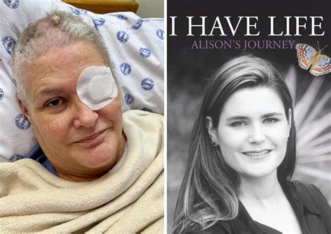 Alison Botha Injuries