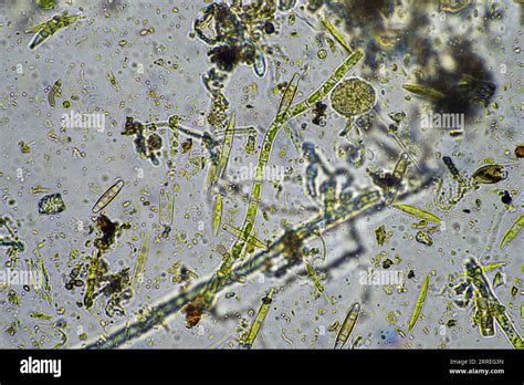 Fungi Under Microscope