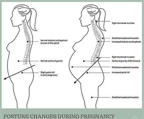 Mid Back Pain Pregnancy